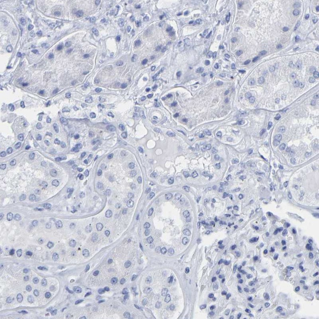 Cytokeratin 1 Antibody in Immunohistochemistry (Paraffin) (IHC (P))