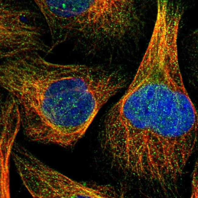 RNF141 Antibody in Immunocytochemistry (ICC/IF)