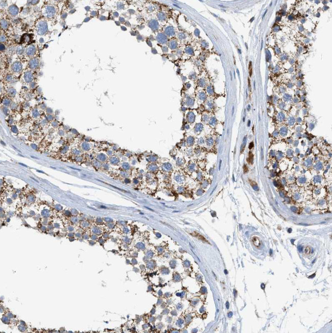 GOT2 Antibody in Immunohistochemistry (Paraffin) (IHC (P))