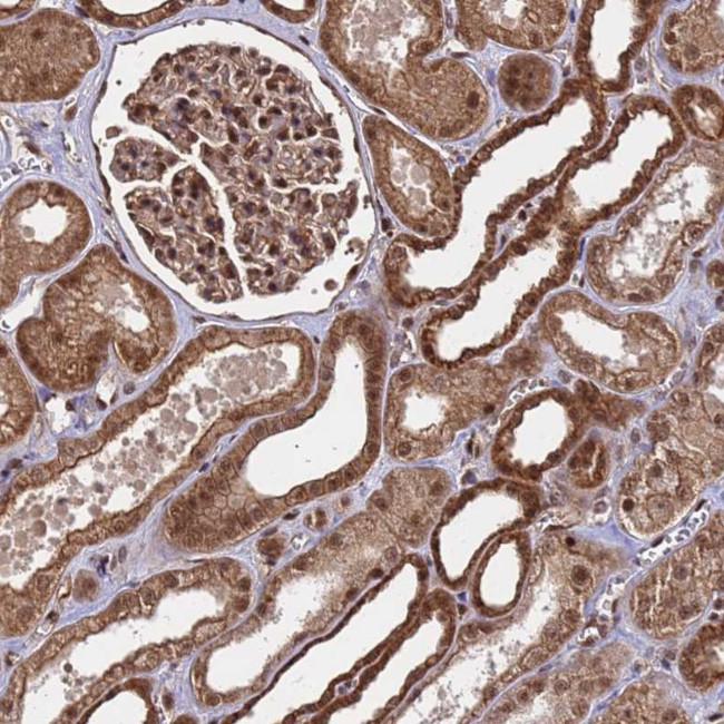 SYF2 Antibody in Immunohistochemistry (Paraffin) (IHC (P))