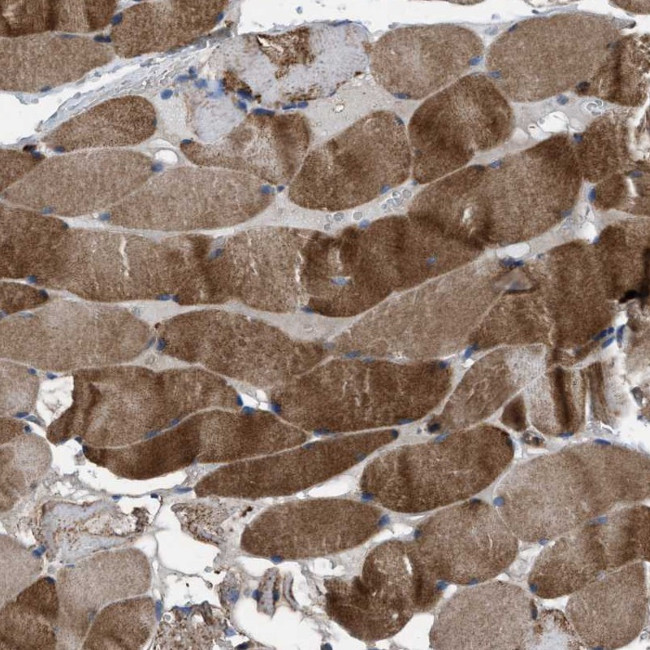 USP25 Antibody in Immunohistochemistry (Paraffin) (IHC (P))