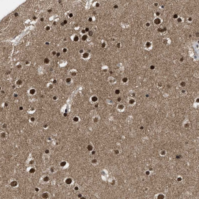 ZNF346 Antibody in Immunohistochemistry (Paraffin) (IHC (P))