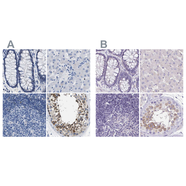 BOLL Antibody in Immunohistochemistry (Paraffin) (IHC (P))