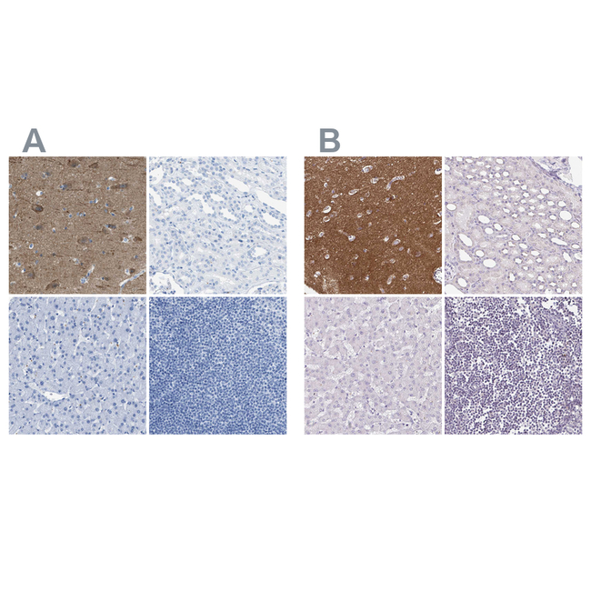 LFG Antibody in Immunohistochemistry (Paraffin) (IHC (P))