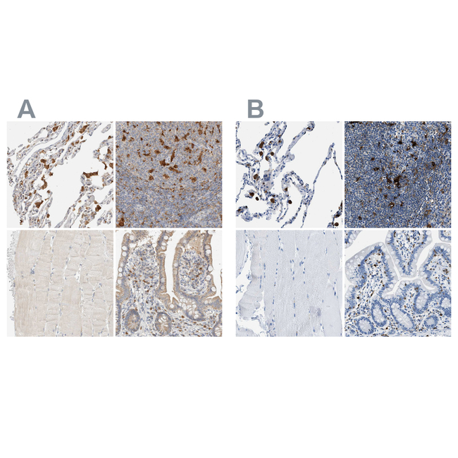 CAPG Antibody in Immunohistochemistry (Paraffin) (IHC (P))