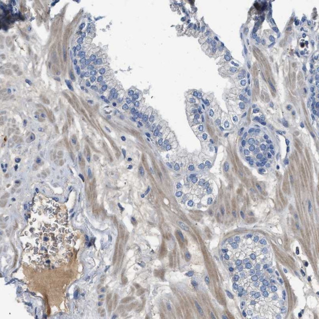 C1S Antibody in Immunohistochemistry (Paraffin) (IHC (P))