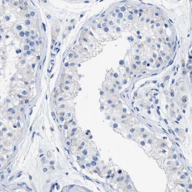 Apolipoprotein L1 Antibody in Immunohistochemistry (Paraffin) (IHC (P))