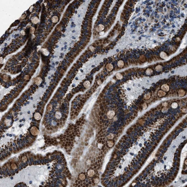 NSD3 Antibody in Immunohistochemistry (Paraffin) (IHC (P))