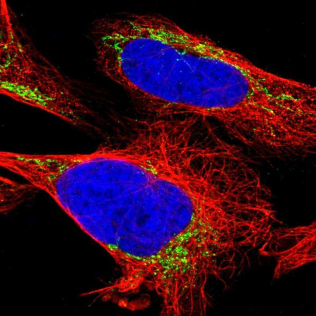 ETFA Antibody in Immunocytochemistry (ICC/IF)
