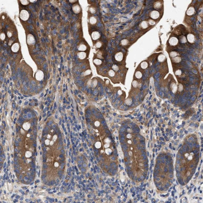 CDKN2C Antibody in Immunohistochemistry (Paraffin) (IHC (P))