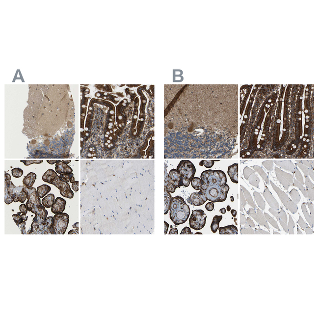 CALM Antibody in Immunohistochemistry (Paraffin) (IHC (P))