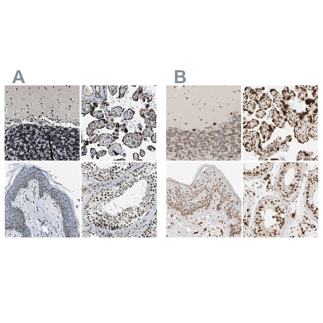 NIPA Antibody in Immunohistochemistry (Paraffin) (IHC (P))