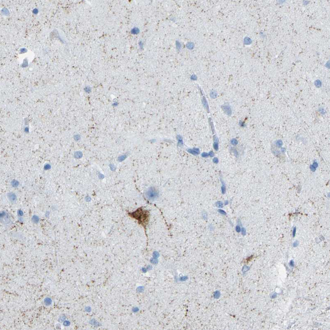Somatostatin Antibody in Immunohistochemistry (Paraffin) (IHC (P))