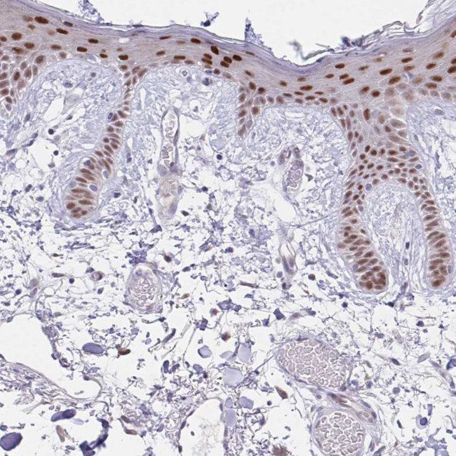 POU2F3 Antibody in Immunohistochemistry (Paraffin) (IHC (P))