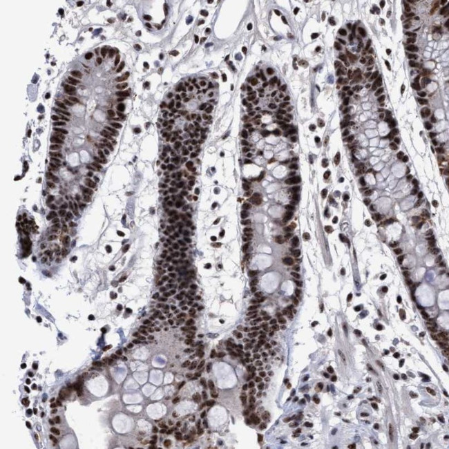 EFCAB10 Antibody in Immunohistochemistry (Paraffin) (IHC (P))