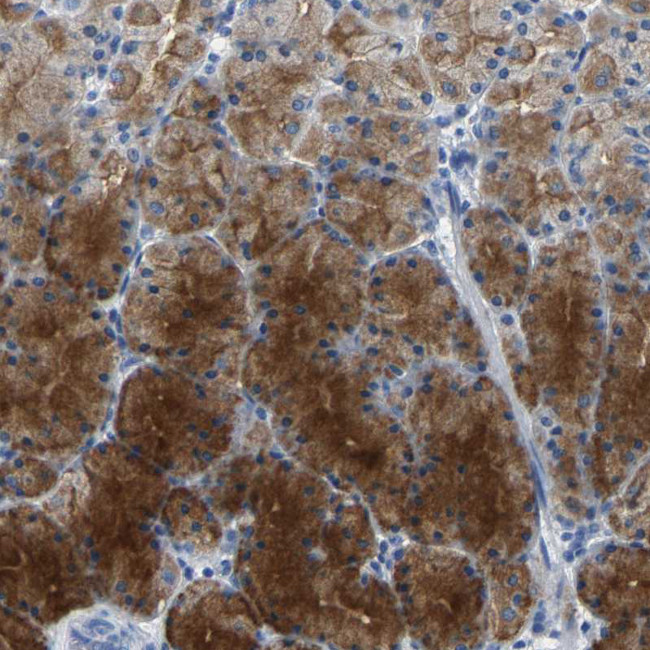Kallikrein 15 Antibody in Immunohistochemistry (Paraffin) (IHC (P))