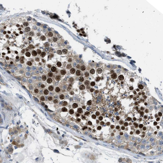 BAZ2B Antibody in Immunohistochemistry (Paraffin) (IHC (P))