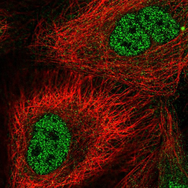 BAG2 Antibody in Immunocytochemistry (ICC/IF)