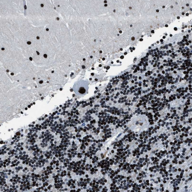 Cyclophilin E Antibody in Immunohistochemistry (Paraffin) (IHC (P))