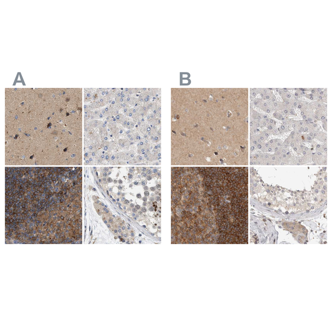 HIP55 Antibody in Immunohistochemistry (Paraffin) (IHC (P))
