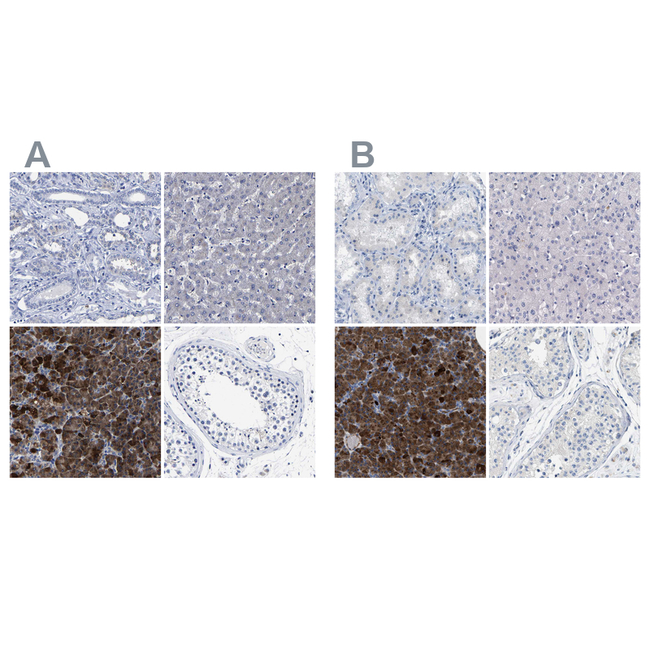 Carboxypeptidase A2 Antibody in Immunohistochemistry (Paraffin) (IHC (P))