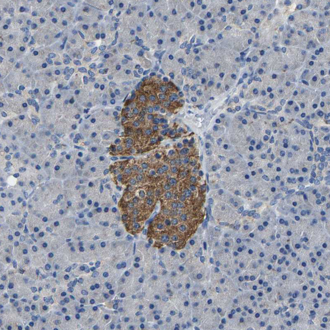 SLC25A25 Antibody in Immunohistochemistry (Paraffin) (IHC (P))