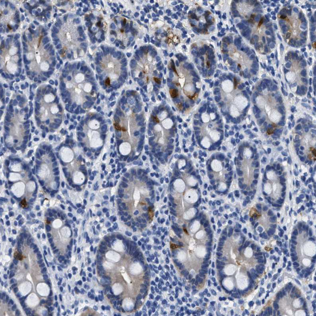 ADH4 Antibody in Immunohistochemistry (Paraffin) (IHC (P))
