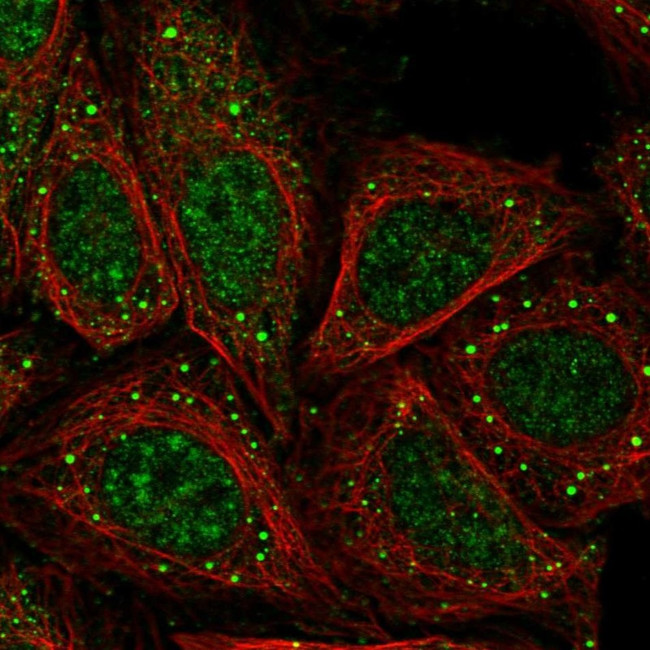 ASAP3 Antibody in Immunocytochemistry (ICC/IF)