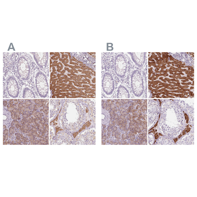 EPHX1 Antibody in Immunohistochemistry (Paraffin) (IHC (P))