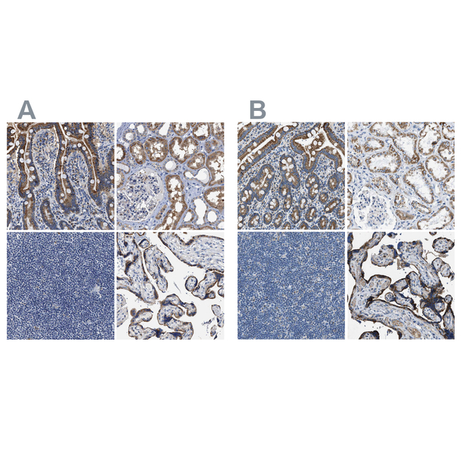 ACADVL Antibody in Immunohistochemistry (Paraffin) (IHC (P))