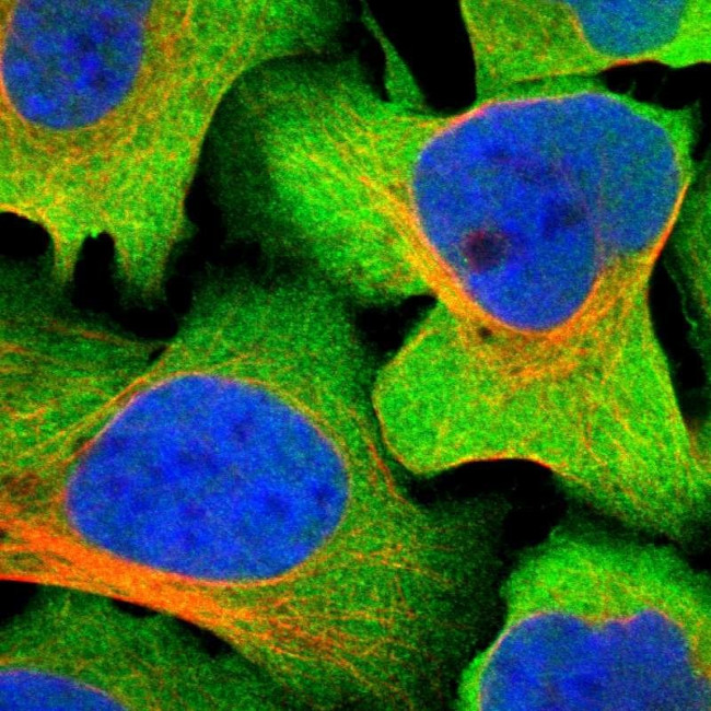GFR alpha-3 Antibody in Immunocytochemistry (ICC/IF)