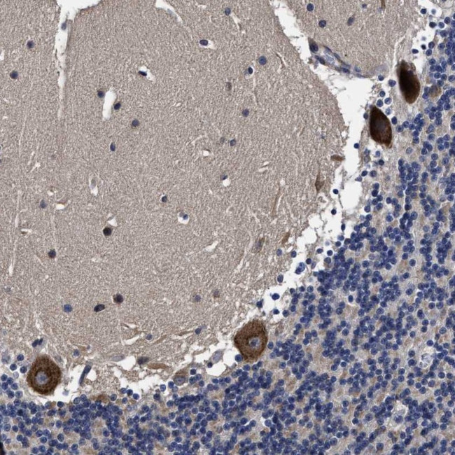 AVEN Antibody in Immunohistochemistry (Paraffin) (IHC (P))