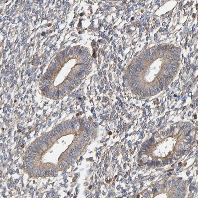 PLA2G3 Antibody in Immunohistochemistry (Paraffin) (IHC (P))