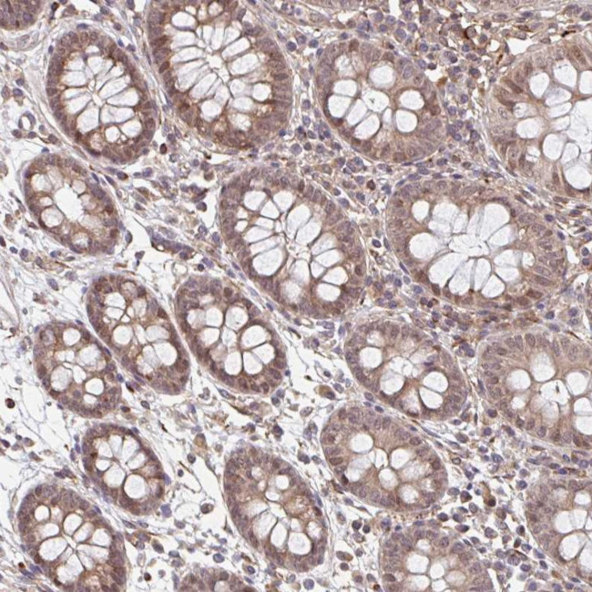 NYREN18 Antibody in Immunohistochemistry (Paraffin) (IHC (P))
