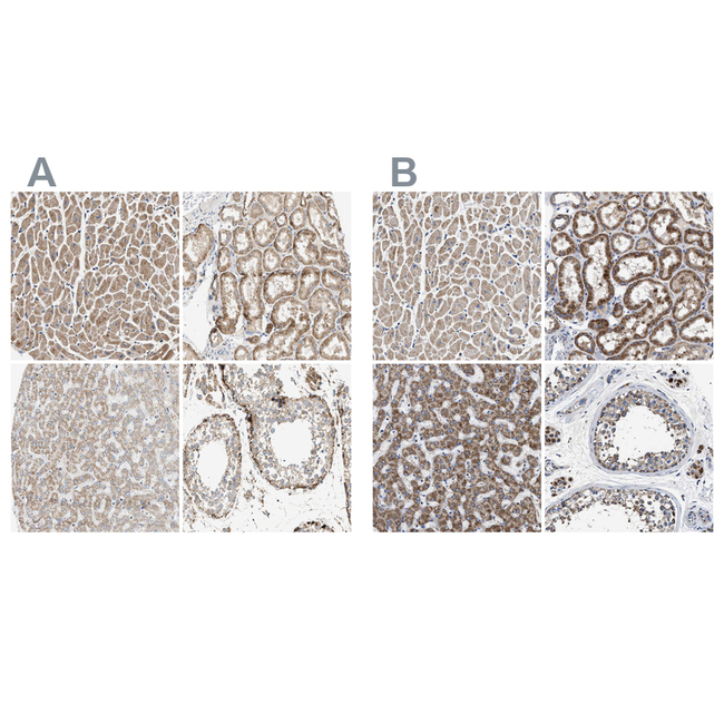 OXSM Antibody in Immunohistochemistry (Paraffin) (IHC (P))