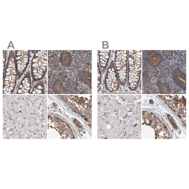 NSP5 Antibody in Immunohistochemistry (Paraffin) (IHC (P))