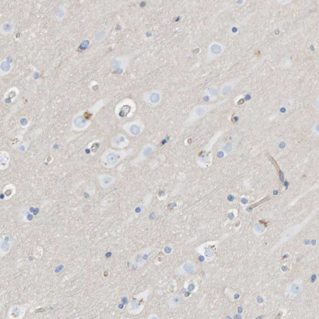 PRKD2 Antibody in Immunohistochemistry (Paraffin) (IHC (P))