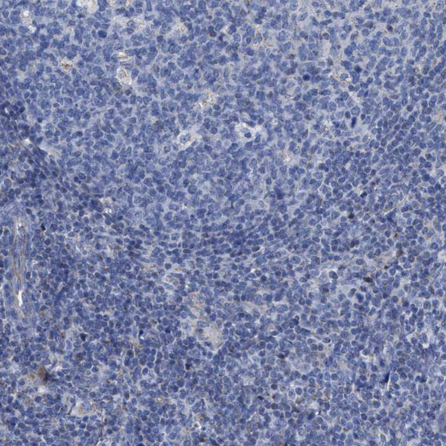 Jagged1 Antibody in Immunohistochemistry (Paraffin) (IHC (P))