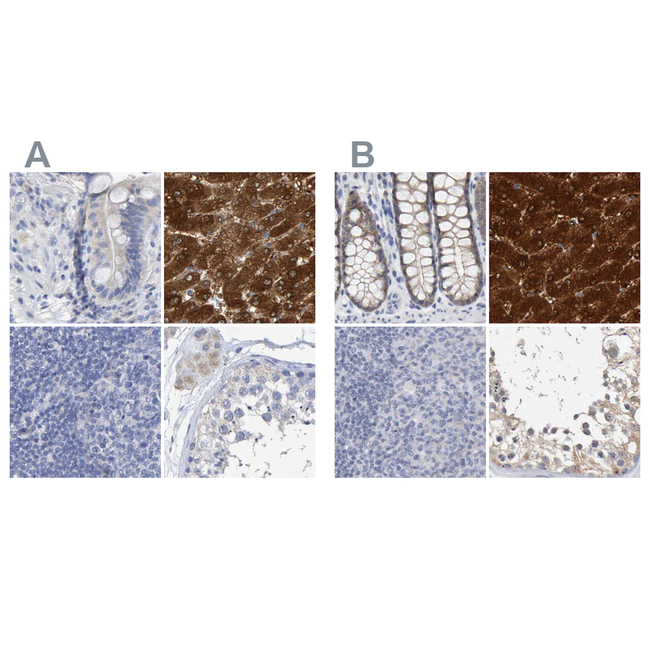 CTH Antibody in Immunohistochemistry (Paraffin) (IHC (P))