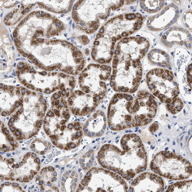 CHRDL2 Antibody in Immunohistochemistry (Paraffin) (IHC (P))