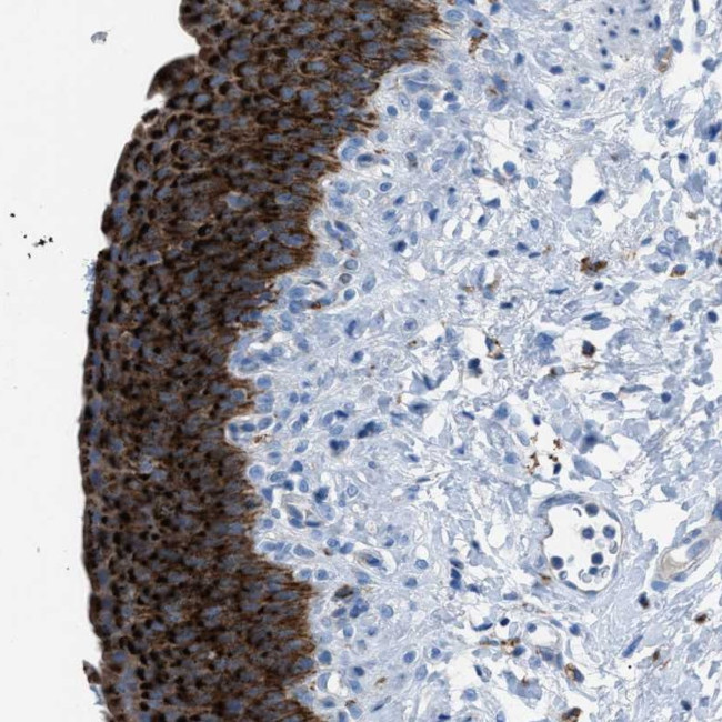 CD1b Antibody in Immunohistochemistry (Paraffin) (IHC (P))