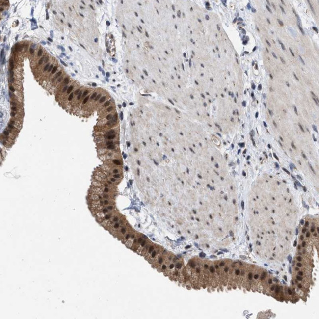 MKNK2 Antibody in Immunohistochemistry (Paraffin) (IHC (P))