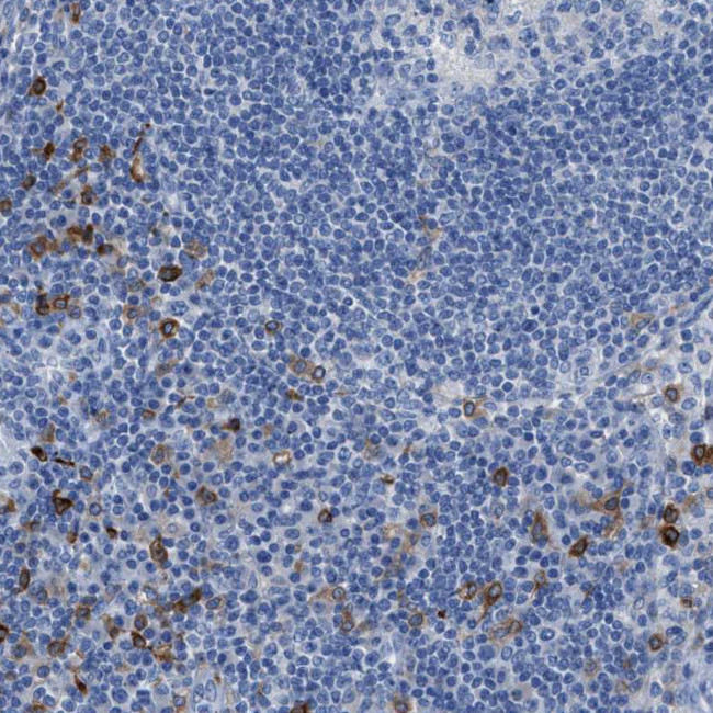 CD301 Antibody in Immunohistochemistry (Paraffin) (IHC (P))