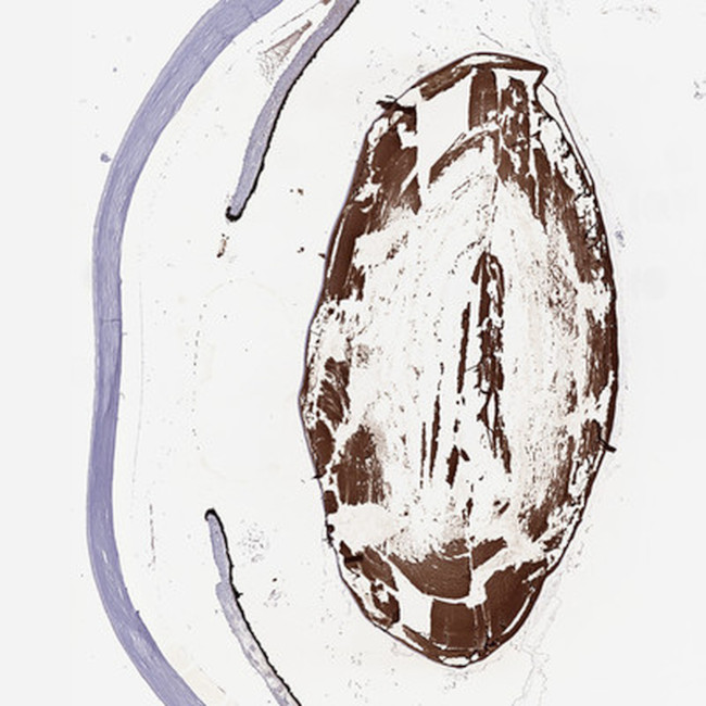 CRYBA1 Antibody in Immunohistochemistry (Paraffin) (IHC (P))