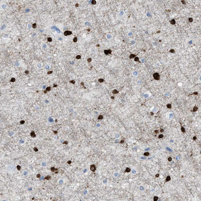 Aspartoacylase Antibody in Immunohistochemistry (Paraffin) (IHC (P))