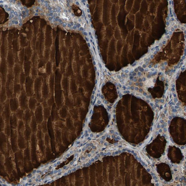 PDE1A Antibody in Immunohistochemistry (Paraffin) (IHC (P))