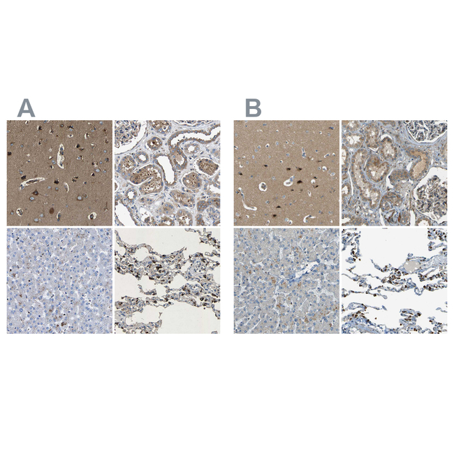 LPCAT1 Antibody in Immunohistochemistry (Paraffin) (IHC (P))