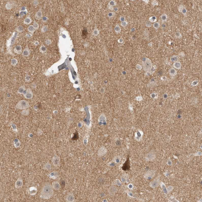 KCNIP1 Antibody in Immunohistochemistry (Paraffin) (IHC (P))
