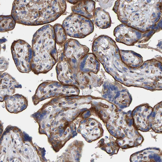 LRP1 Antibody in Immunohistochemistry (Paraffin) (IHC (P))