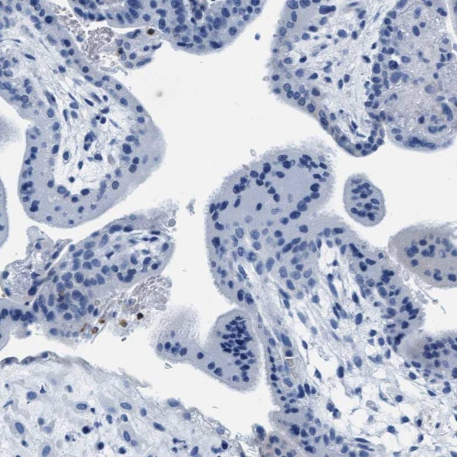 MMP8 Antibody in Immunohistochemistry (Paraffin) (IHC (P))